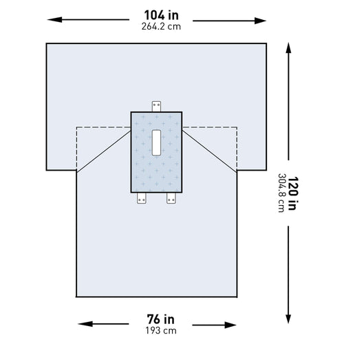 McKesson Abdominal Drape